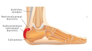 ankle-diagram-1024x565